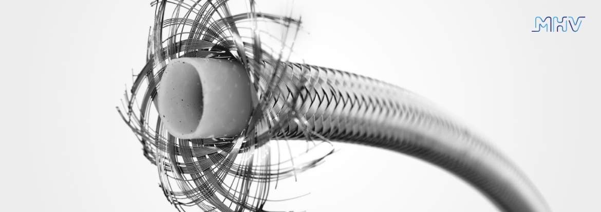 Banner 1 